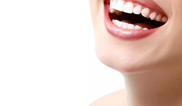 Uzmanı Açıkladı: Diş Beyazlatmanın Herhangi Bir Zararı Yok